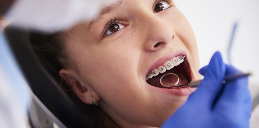 How-much-does-orthodontics-cost-smiles-unlimited-dentist-sydney
