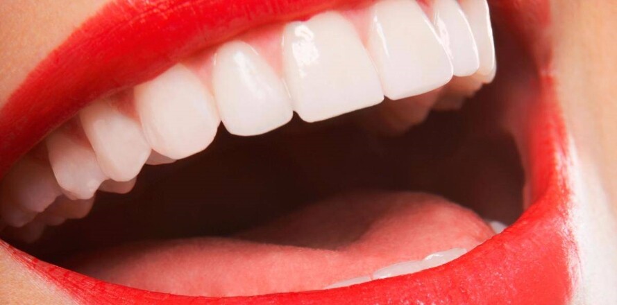 How-much-does-dental-veneers-cost-in-sydney-smiles-unlimited-dental-care
