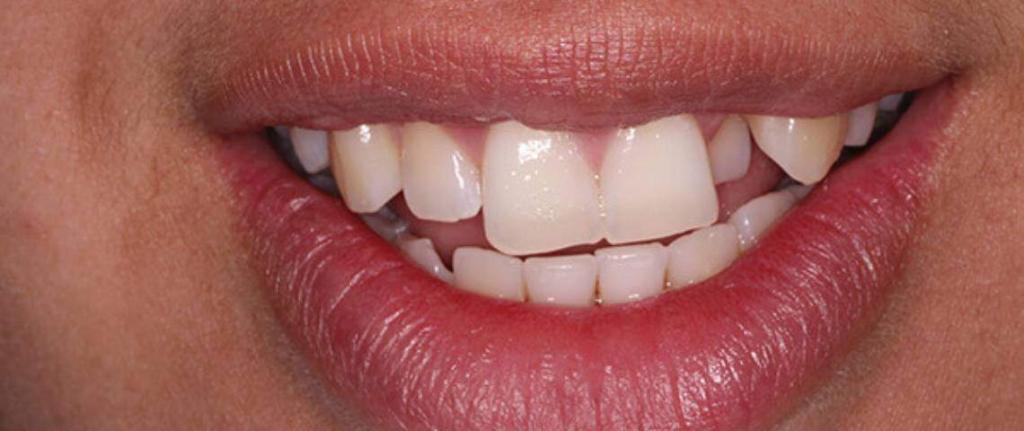 What-do-orthodontics-treat-smiles-unlimited-sydney