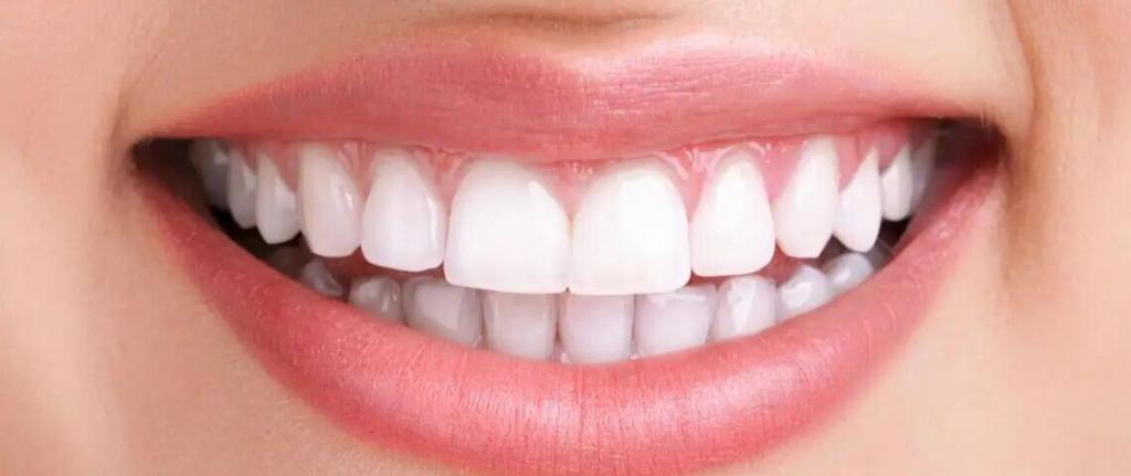 How to Care for Bonded Teeth 
