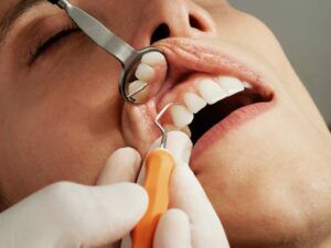 The Benefits of Dental Deep Cleaning - Smiles Unlimited dentist in Sydney