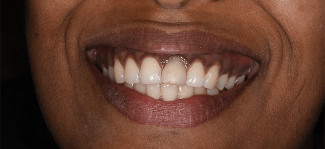 Fairfield Denture Clinic