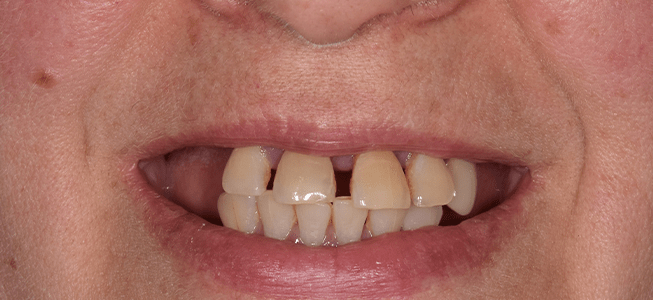 advantages of cosmetic dentistry
